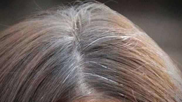 Shkencëtarët zbulojnë arsyen e thinjave në flokë
