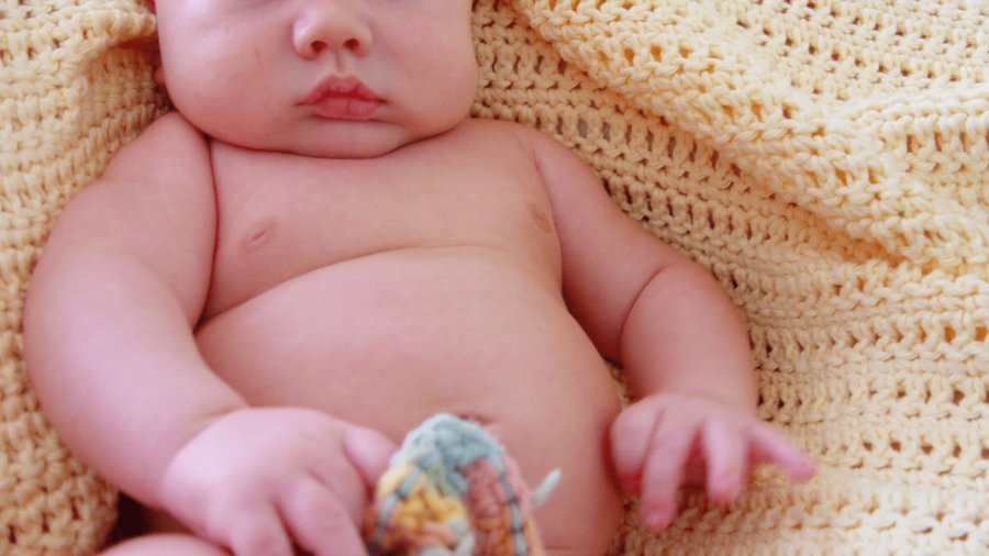 Foshnjat e lindura me prerje cezariane kanë më shumë gjasa të preken nga diabeti ose të jenë obesë
