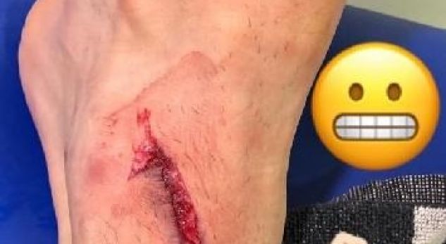 Mandzukic tregon plagët që ia shkaktoi mesfushori i Interit