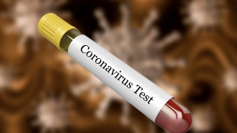 Dy persona të Gadimes së Eperme rezultojnë negativ në testin e COVID-19