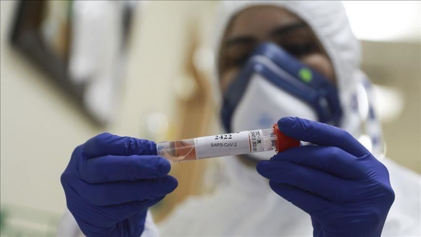 Alarmante: 7 raste të reja me Koronavirus në Lipjan